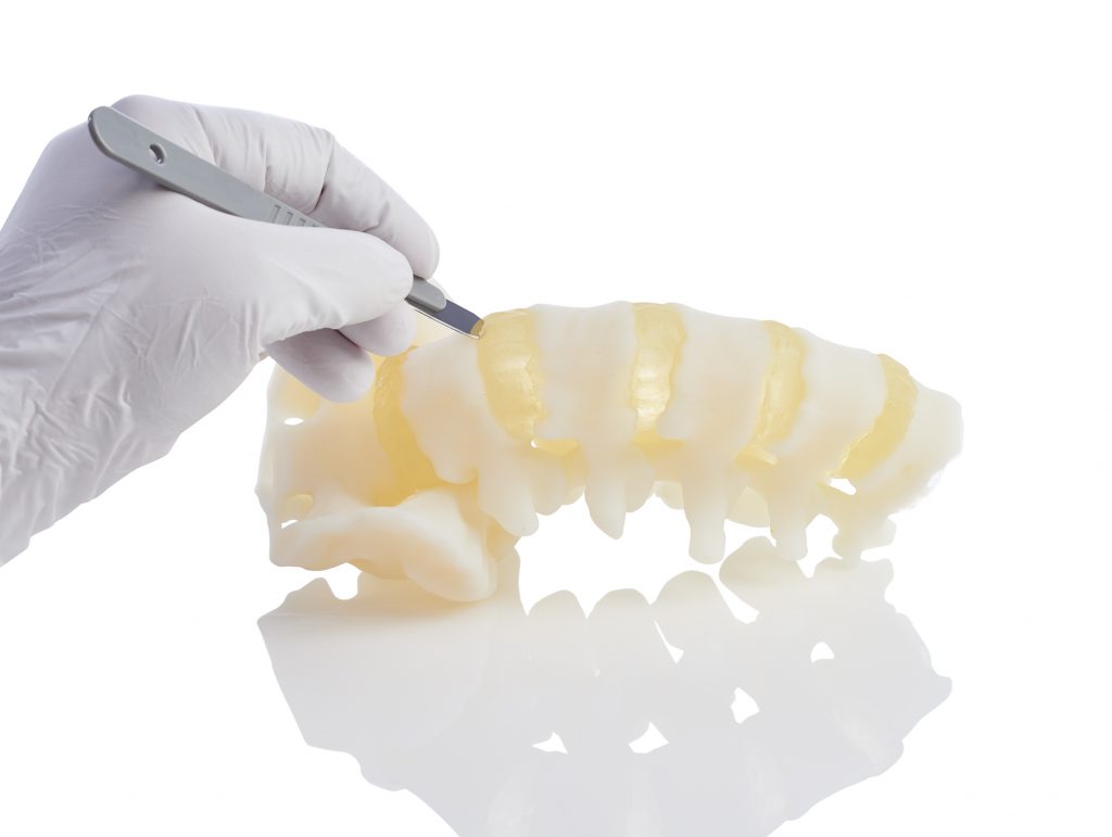 Using a multi-material 3D-printed model for training a surgeon to perform a spinal discectomy: step one, an incision between sections of 